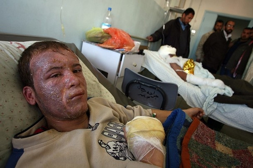 White phosphorus 7