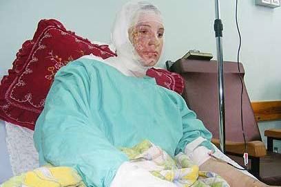White phosphorus 8