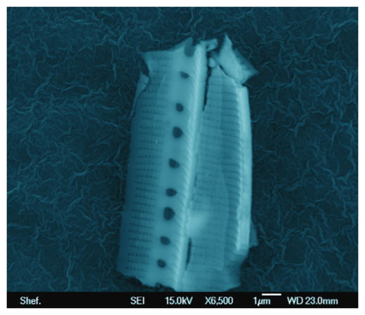 Click to enlarge Nitzschia