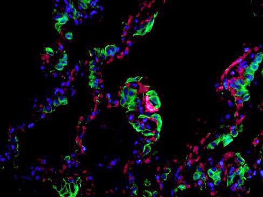 mers virus
