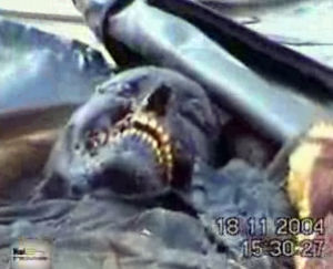 Fallujah White Phosphorous Victim