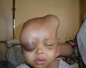 Fallujah Weapons Victim