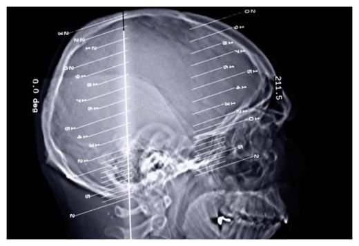Brain