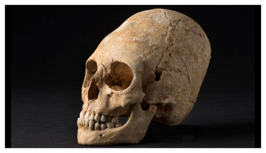 Deformed Skull_1