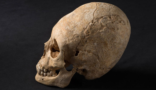 Click to enlarge Deformed Skull_2