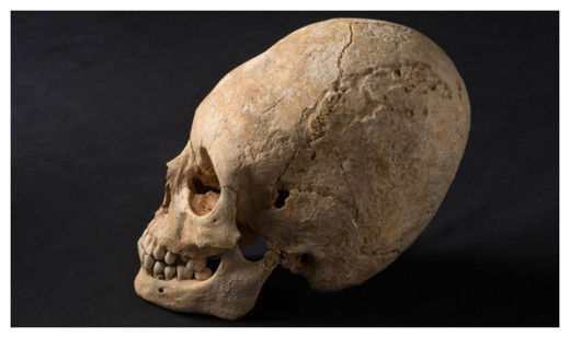 Deformed Skull_2