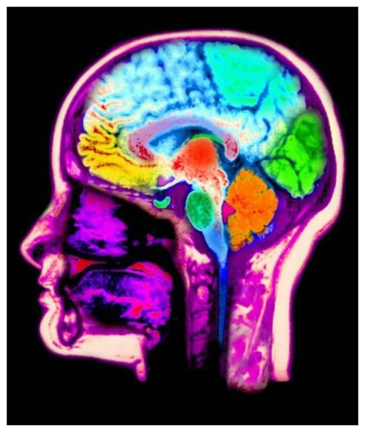 Click to enlarge Brain
