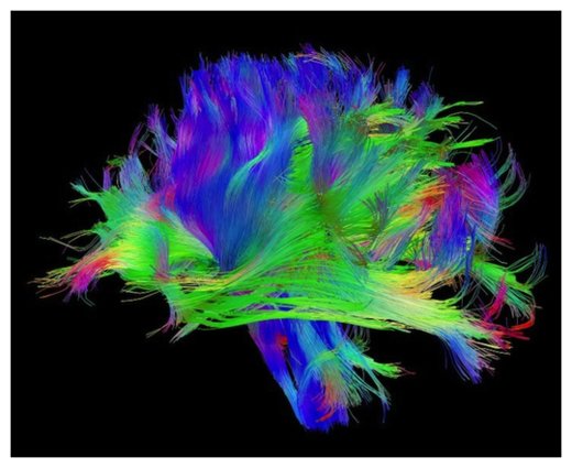 Click to enlarge Neural Circuits