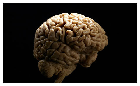 Click to enlarge The Brain