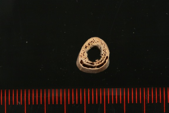 Humerus Bone
