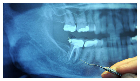 Dentist Visit