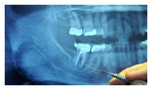 Dentist Visit