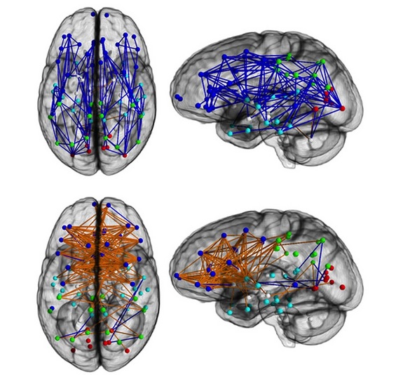 Brain Differences