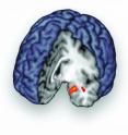 Click to enlarge brain study