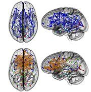 Click to enlarge male & female brains 2