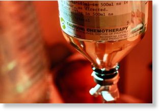 chemo