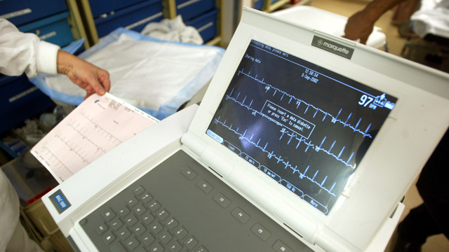 heart monitor