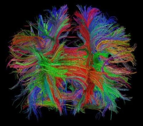 Click to enlarge brain connections