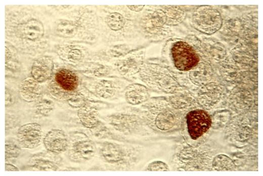 Click to enlarge Chlamydia Bacteria