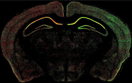 mouse brain