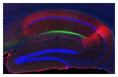 Hippocampus 