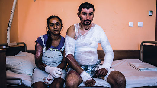bulgaria burn victim