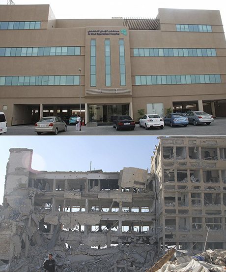 al-kindi hospital syria before after