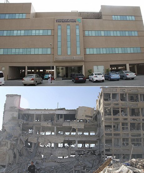 Click to enlarge al-kindi hospital syria before after