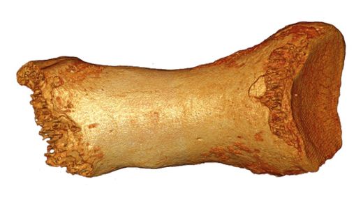 Click to enlarge Toe Bone