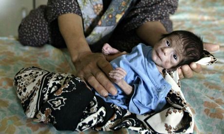 Click to enlarge A baby in a Baghdad hospital