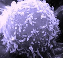 Click to enlarge cancer cell
