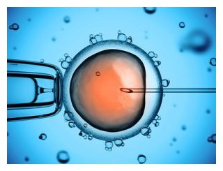 Human Embryo