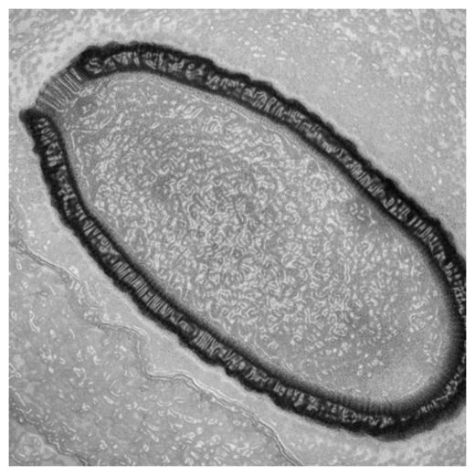 Virus