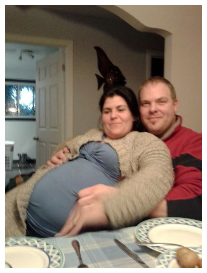 False Pregancy