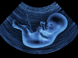 fetus