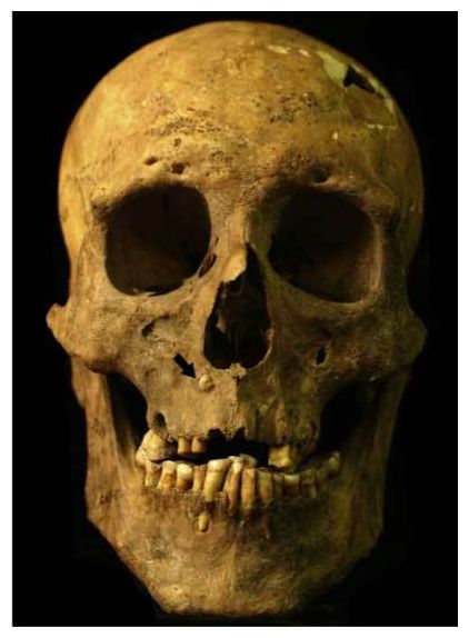 Click to enlarge Ancient Skull
