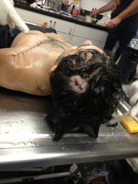 Todashev autopsy