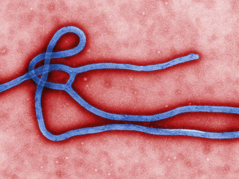 Click to enlarge ebola virus mikroskopaufnahme