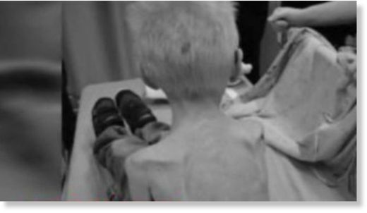 Click to enlarge malnourished boy texas