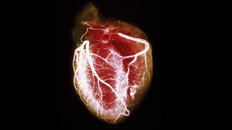 Click to enlarge heart
