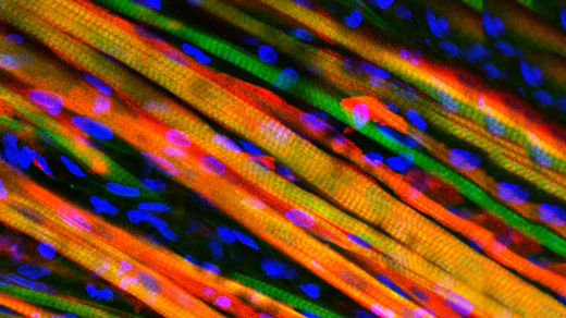 engineered muscle fiber