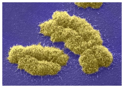 Y chromosome