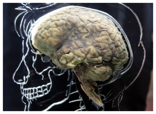 Human Brain