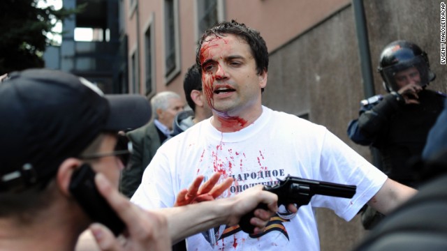 Injured Pro-Russian activist
