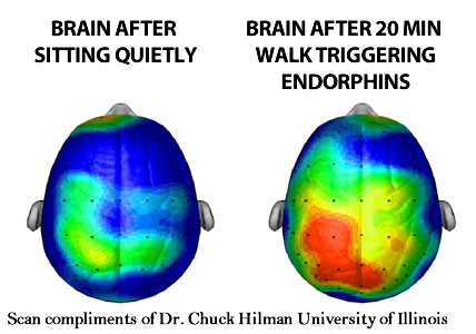 brain scan