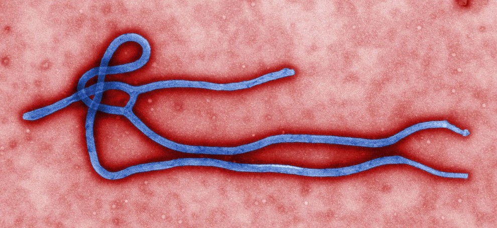 Ebola 