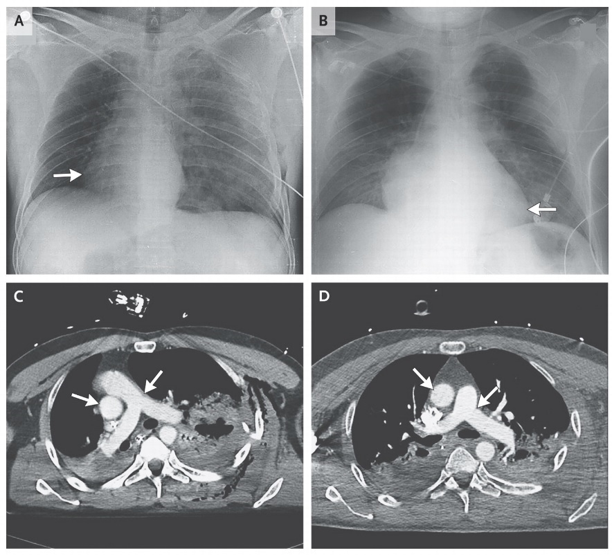 X-ray and CT scan