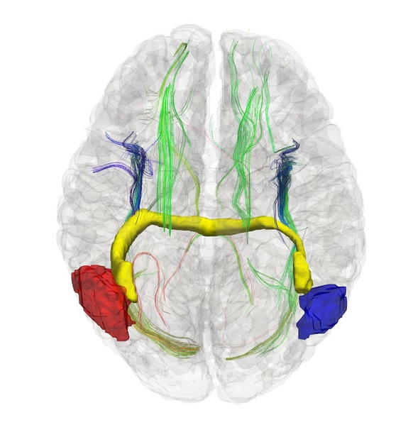 Click to enlarge Brain