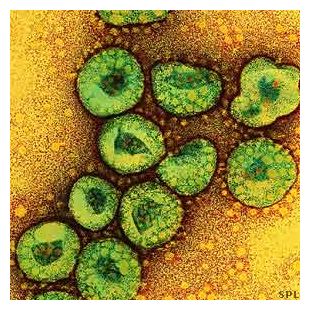 Click to enlarge SARS Virus