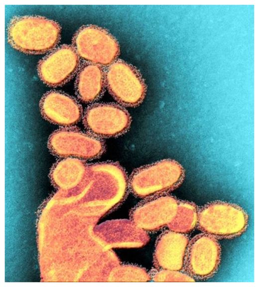 Spanish Flu Virus_1